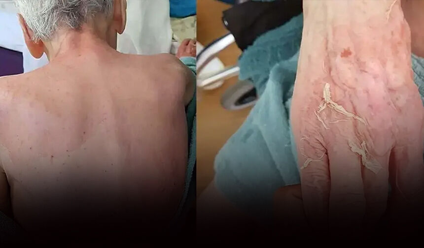Huzurevindeki ölümde 6 taksitli cezanın gerekçesi: Tedbir alınmamış!