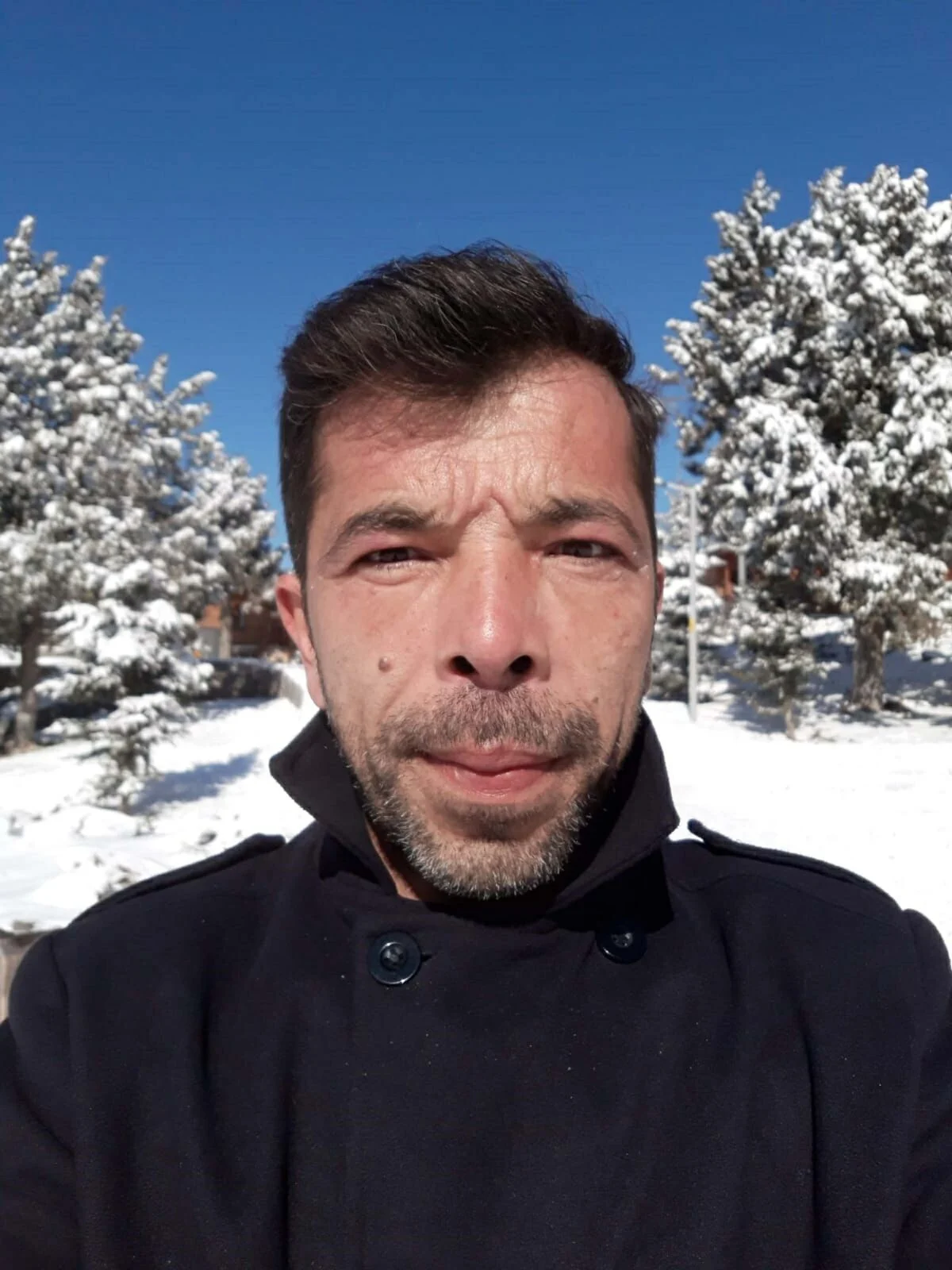 Organlari 3 Hastaya Umut Oldu 19903564 Amp